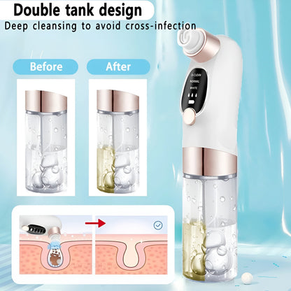 Portable Electric Rechargeable Bubble Blackhead Remover Pore Vacuum Cleaner with Interchangeable Heads